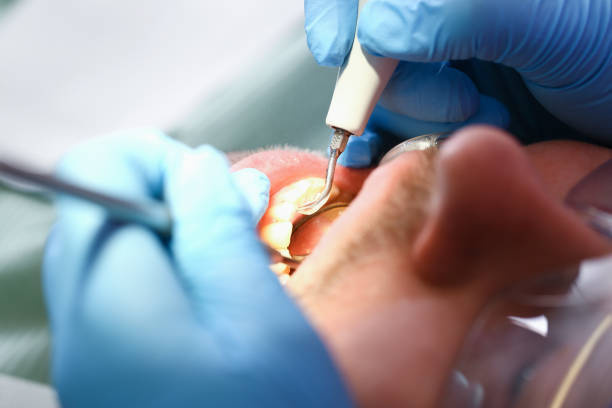 Best Same-Day Emergency Dentist in Sherrill, NY